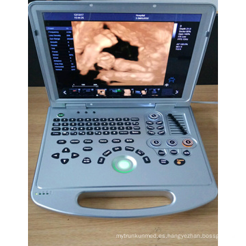 DW-C60PLUS color Doppler médico ultrasonido escáner de China para la venta